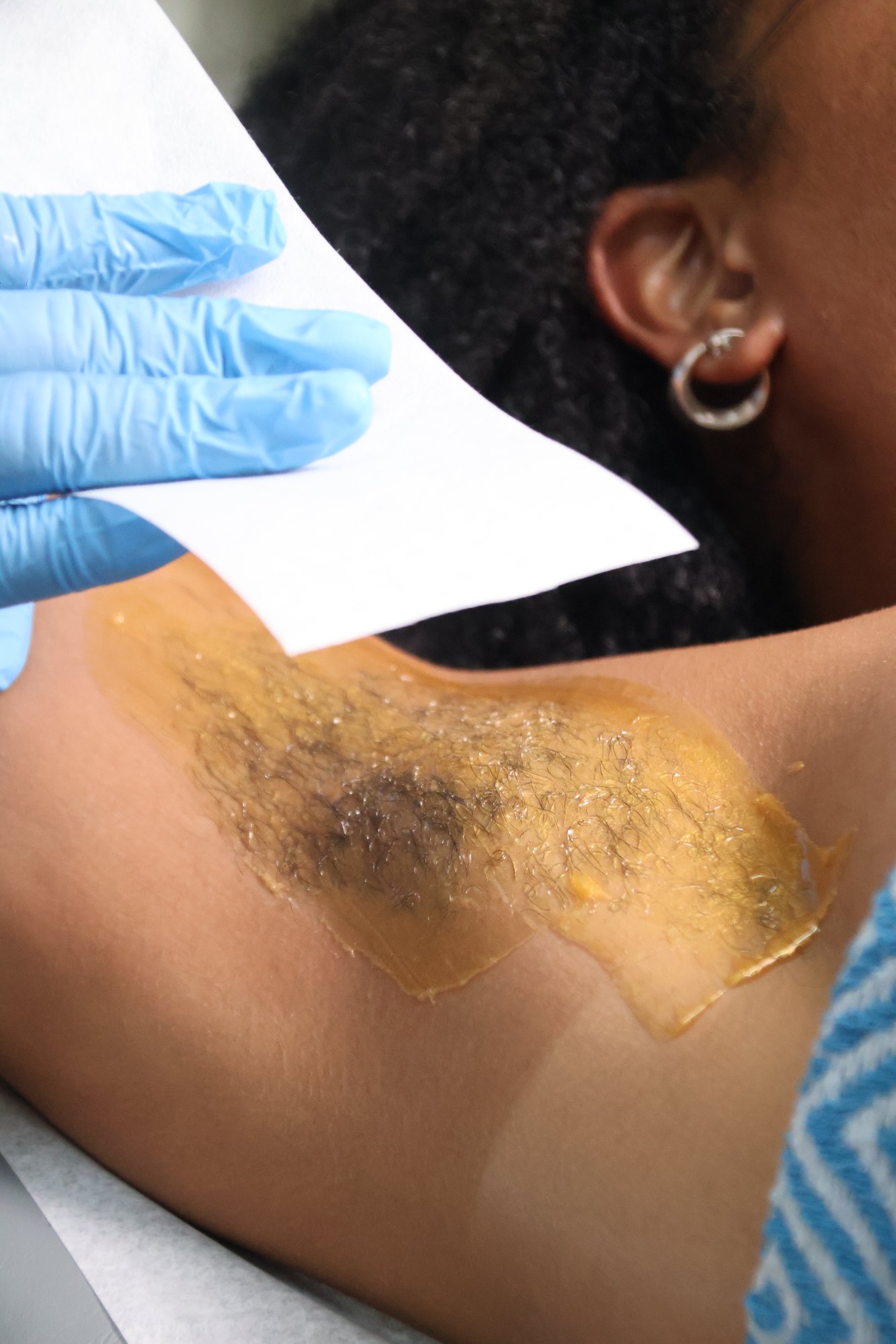 KiWest Spa underarm waxing service in Bridgetown, Barbados